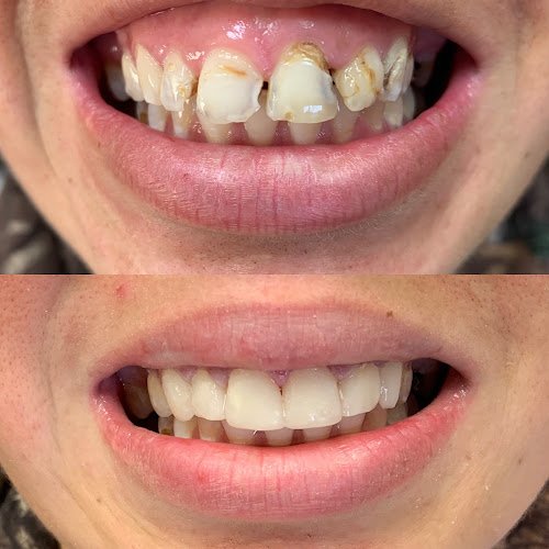 Dentist Greeneville – ABC Family Dentistry