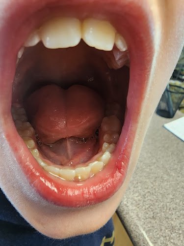 Dentistry at Marysville – Implant, Cosmetic, and Family Dentistry