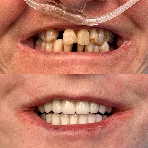 Texas Implant & Dental Center of Amarillo