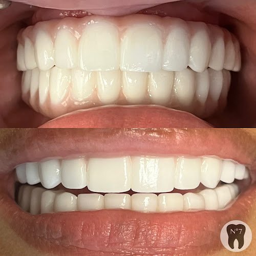 TOOTH No.7 Dentist at Memorial