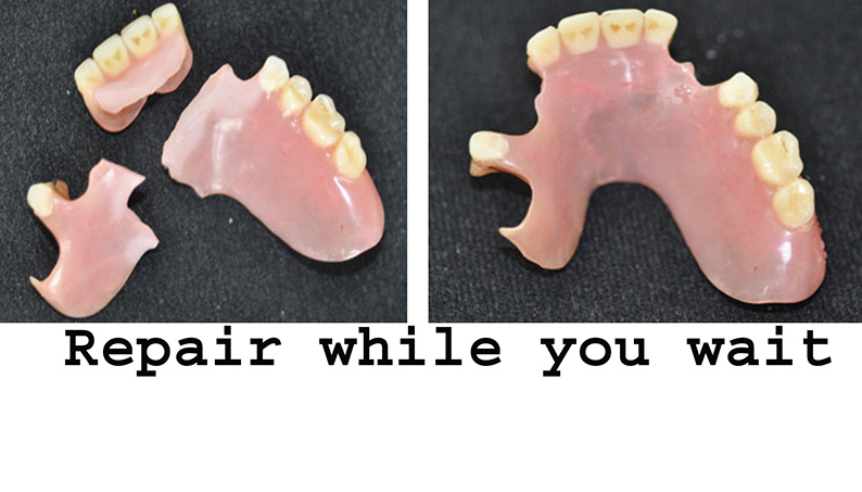 Palm Harbor Denture Repair