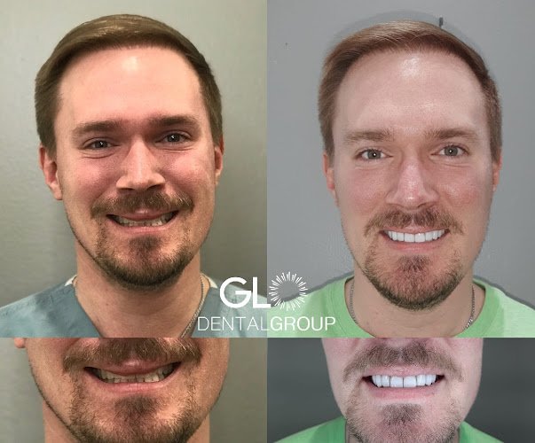 Glo Dental Group