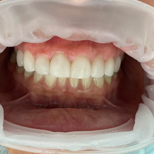 Lux Dental Studio – Houston