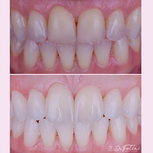 Fotini Chrisopoulos DDS, MS- Prosthodontist
Cosmetic & Implant Dentistry