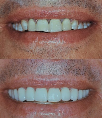 Lakeside Dental Solutions – Rowlett