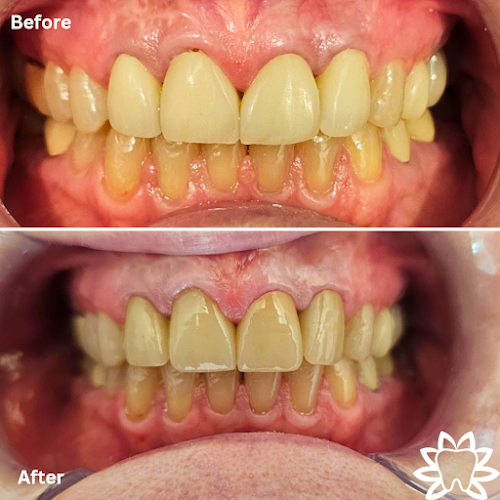 Highlight Family Dentistry of Hutto