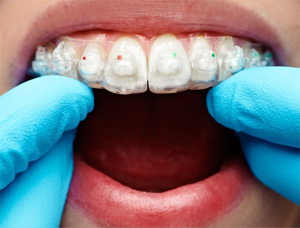 Hutto Hippo Family Dental