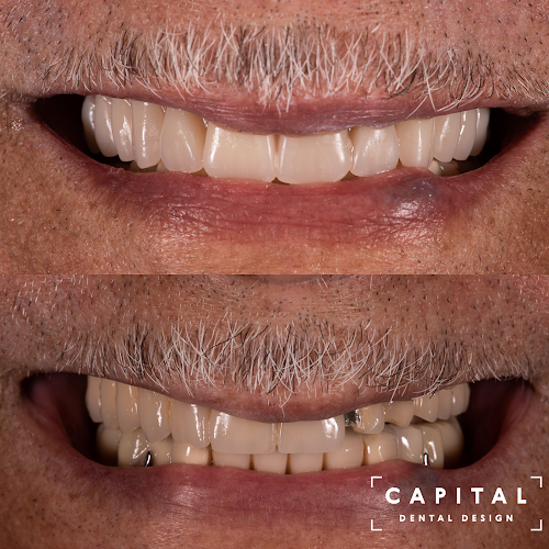 Capital Dental Design – Richmond
