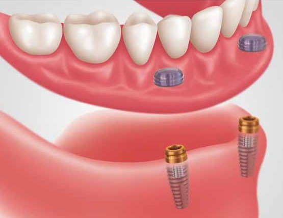 Village Family Dental – Dentist in Dallas, Duncanville