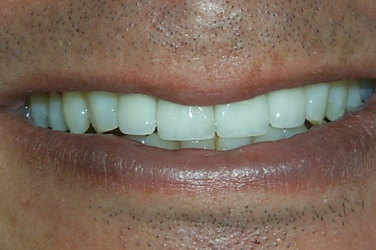 Lonestar Dental Group Plano