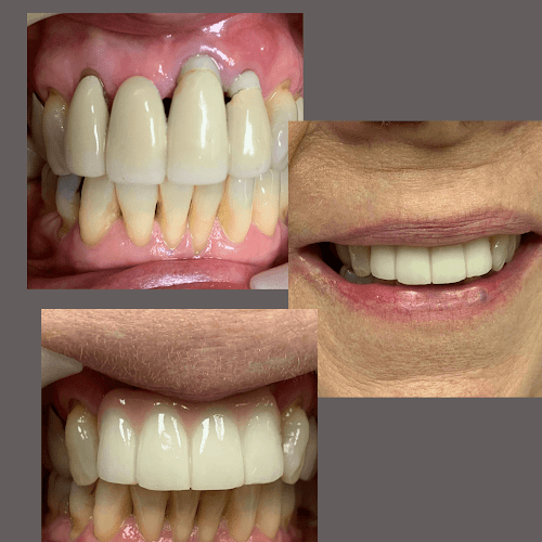 All Smiles Dentistry Allen