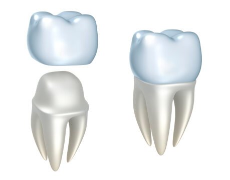 Dental crowns and tooth