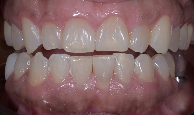 Advanced Dental Care of Allen