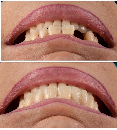 Charm Dental Richmond