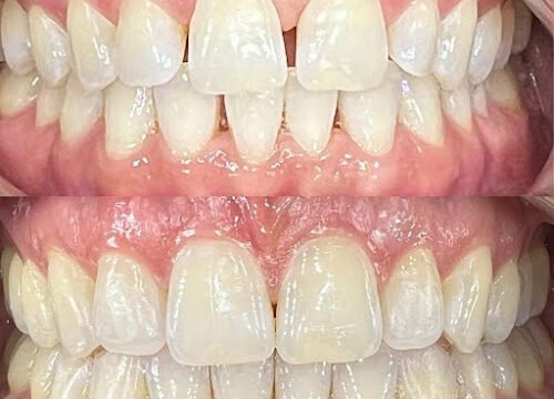 xr:d:DAFX6VUi4cY:1028,j:6192858168206542142,t:23110917