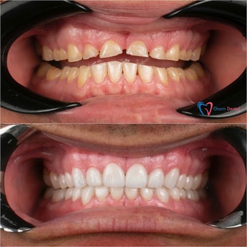 Charm Dental Humble