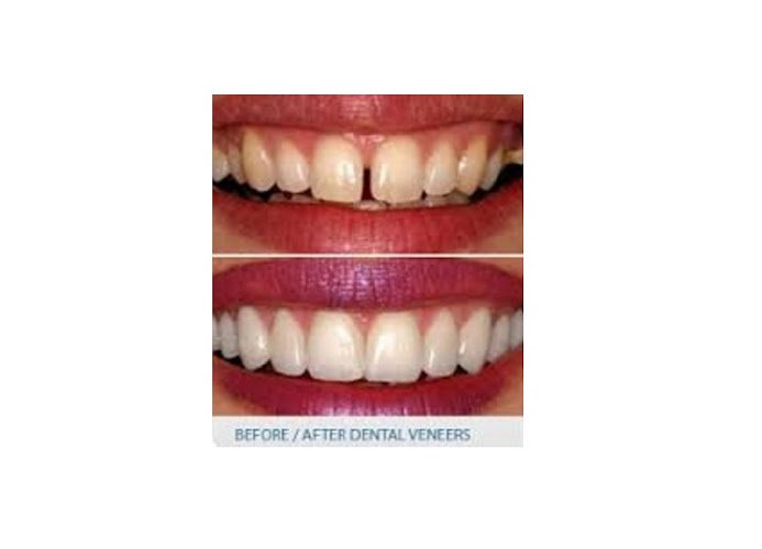 Young Family Dental Orem