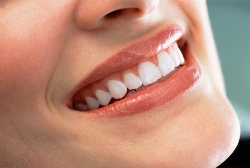 Close up of smiling womanÂs teeth