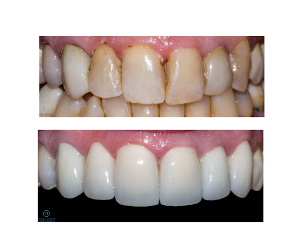 Fossil Ridge Family Dentistry