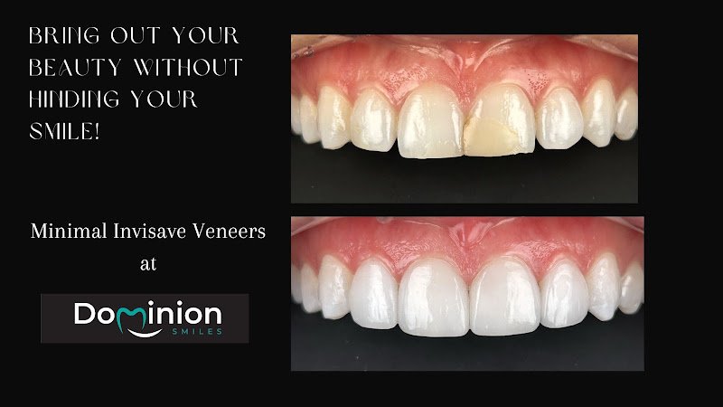 Dominion Smiles – General and Cosmetic Dentistry