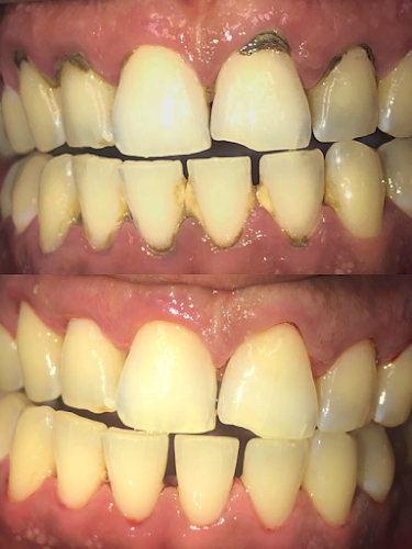 Perfect 32 Family Dentistry