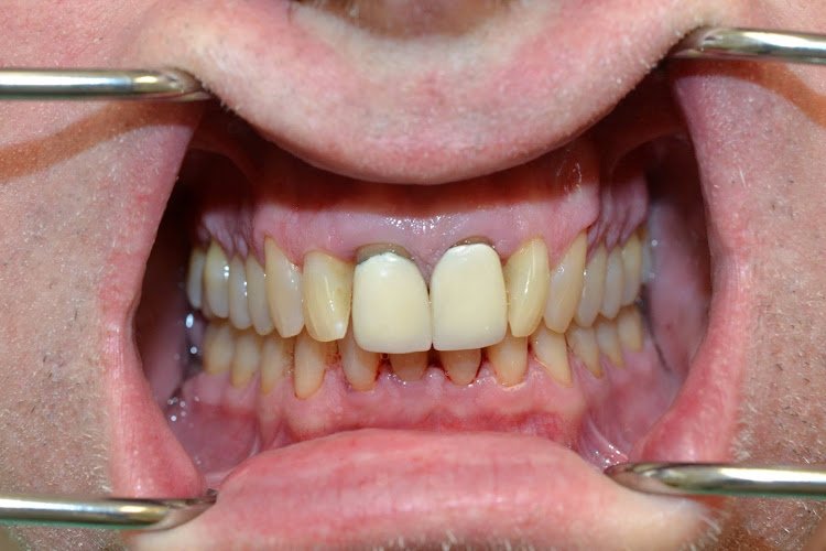 PK Cosmetic and Family Dentistry