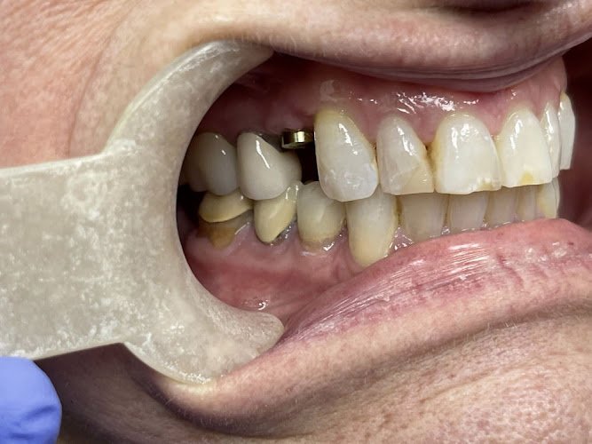 Towne View Dental Care
Best Dentist in Flower Mound, TX