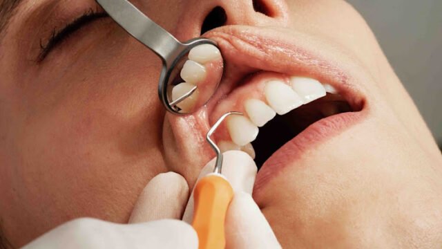 Common Types of Cosmetic Dentistry Procedures – District Dentistry