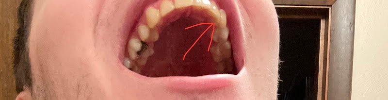 Crow Dental Associates