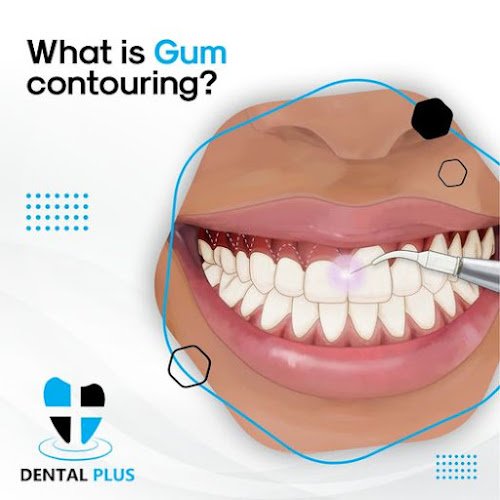 Dental Plus Clinic of Beeville (Wonder Smile)