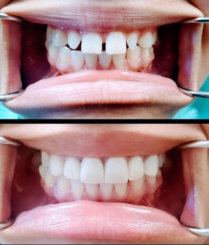 Complete Dental Care