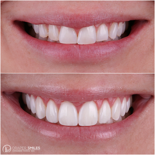 Draper Smiles – Dr. Fernando Pessoa: World-Class Dentistry