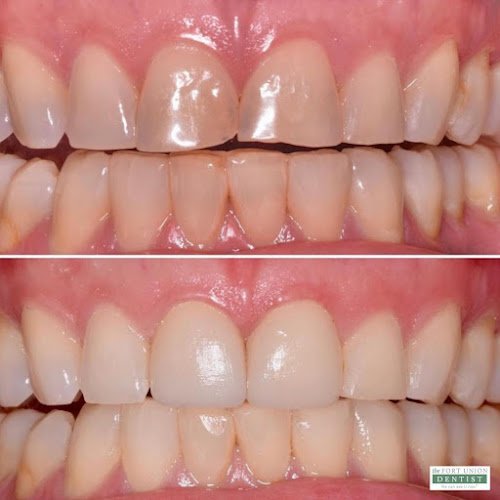 The Fort Union Dentist