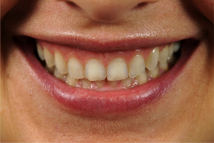 Lebeau Dental Laboratory Inc