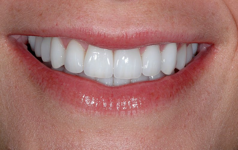 Tysons Aesthetic Dentistry