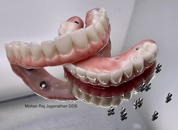 Elite Dental – Mohan Raj Jaganathan DDS & Veena Raja DDS PhD