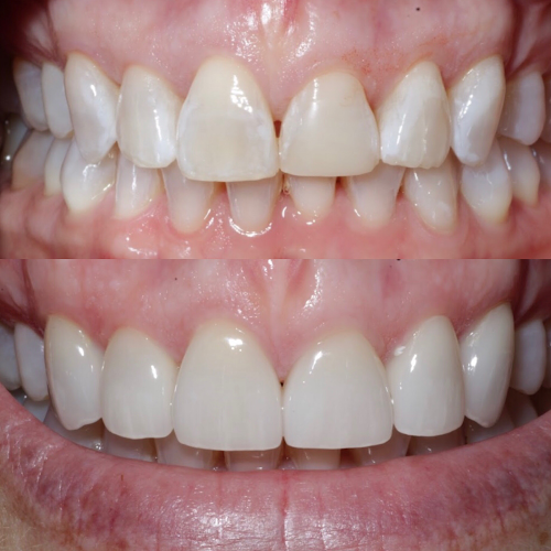 Promont Dental Design